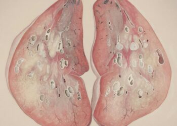 The Liver Renew Promise: An Evidence-Based Deconstruction of the Science, Hype, and Hope Behind Liver Detox Formulas