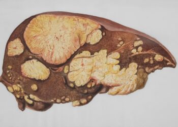 Beyond the Detox Myth: I’m a Practitioner, and This Is How Liver Health Actually Works